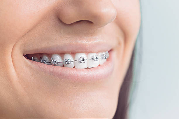 Best Pediatric Dentistry  in Winner, SD